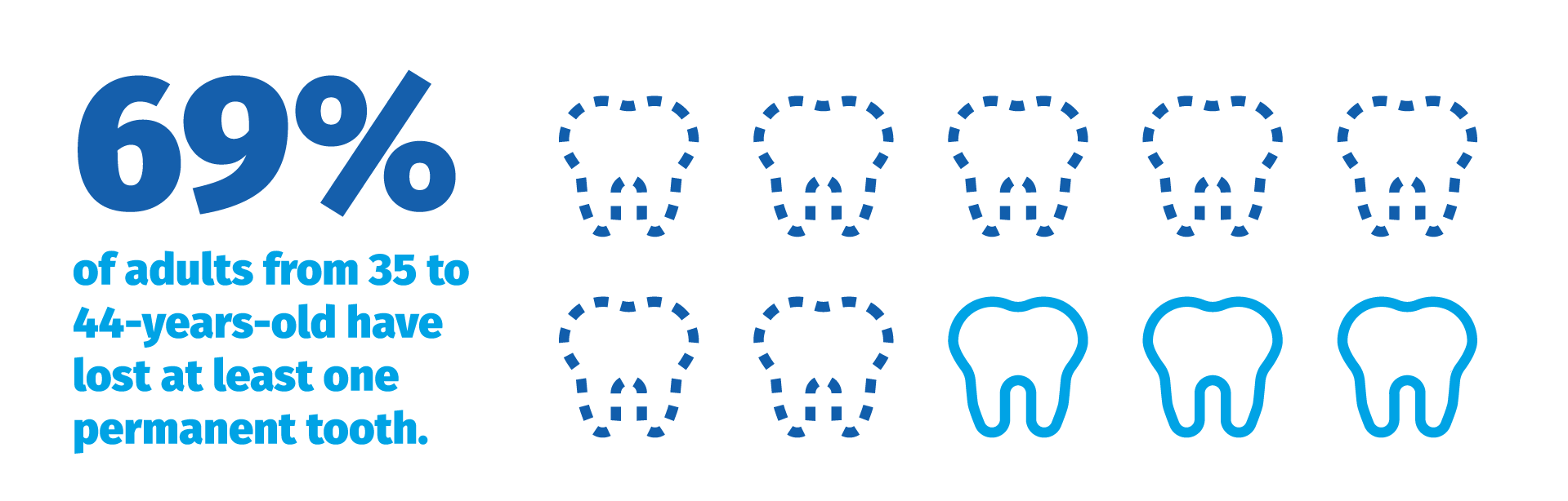 What's a Missing Tooth Clause?